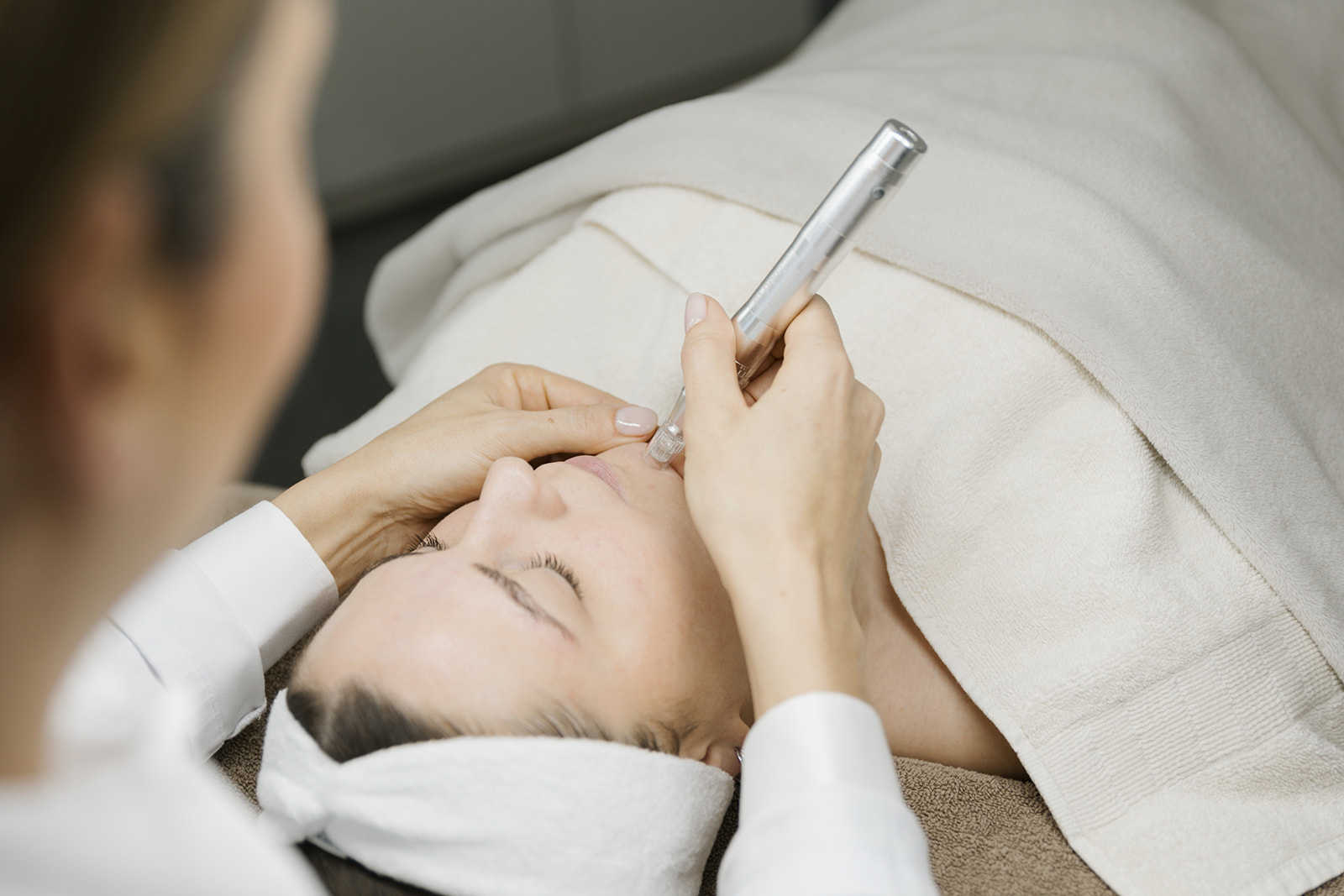 Microneedling-Leistung